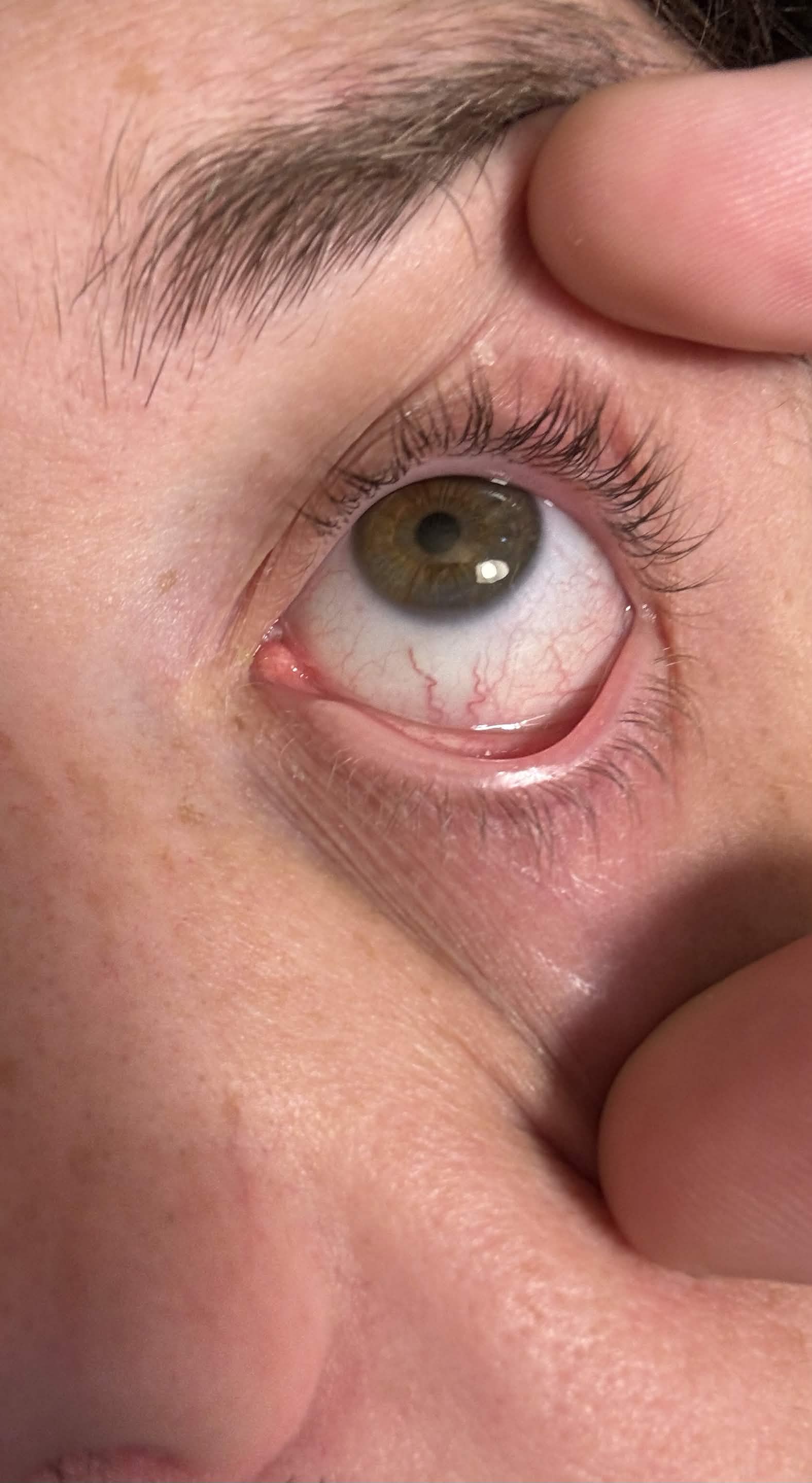 $MYEYE Eye